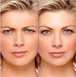 botox before and after photo by advanced medical spa laser center in flemington nj
