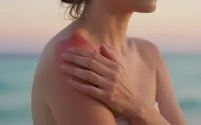 Looking For a Way To Treat Your Sun Damaged Skin?