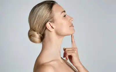 Injections of Kybella Reduce a Double Chin