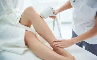 Check Out Our Summer Laser Hair-Removal Special!