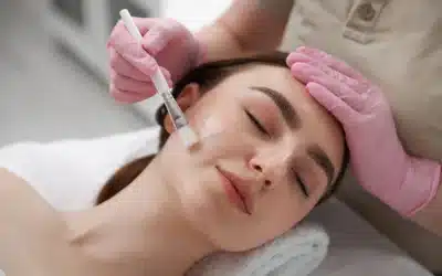 The Skin Issues a Chemical Peel Can Treat