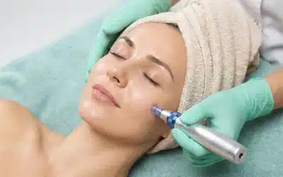 Combining Your Microneedling Treatment with PRP