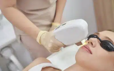 Eliminate Your Sun Spots with IPL Photo Rejuvenation