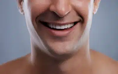 Enhancing the Definition of the Male Jawline with Kybella