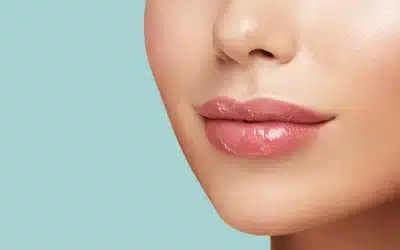 Lip Enhancement Using Dermal Fillers