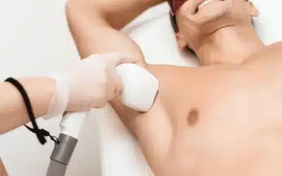 Laser Hair Removal for the Male Body