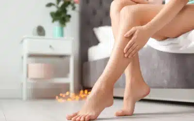 Feel Confident About Your Legs with Sclerotherapy